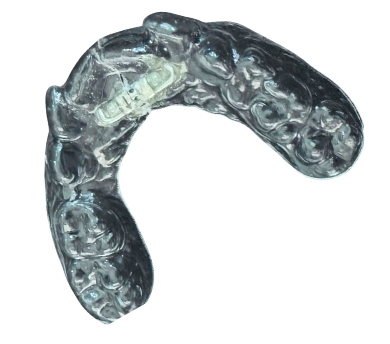Clear aligner tray