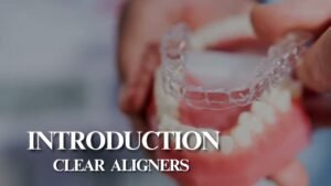 Introduction to Clear Aligners