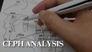 Ceph Analysis