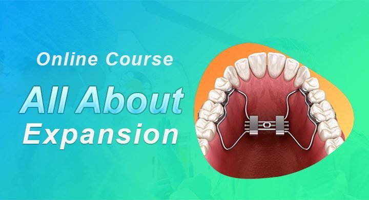 All About Expansion