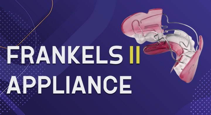 Frankels II Appliance