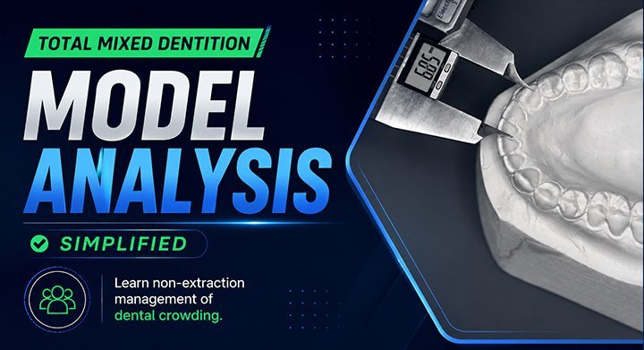 Model Analysis