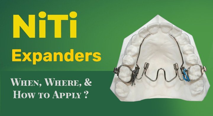 NiTi Expanders