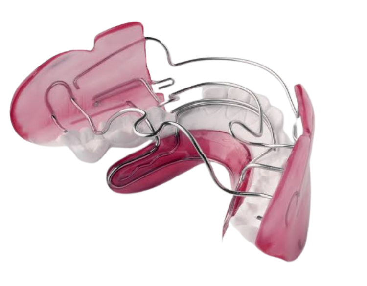 Frankel II functional appliance